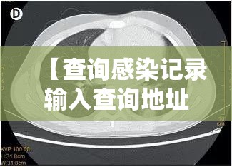 【查询感染记录输入查询地址,人体结构几何体速写】 【查询感染记录输入查询地址,人体结构几何体速写】