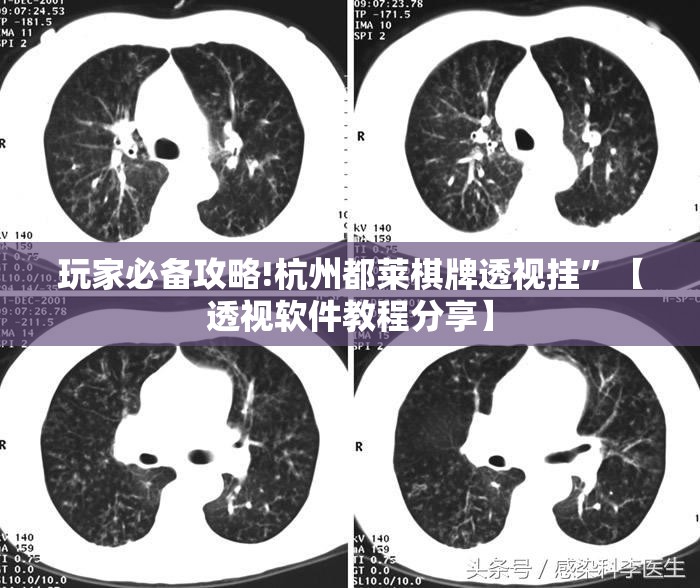 玩家必备攻略!杭州都莱棋牌透视挂”【透视软件教程分享】